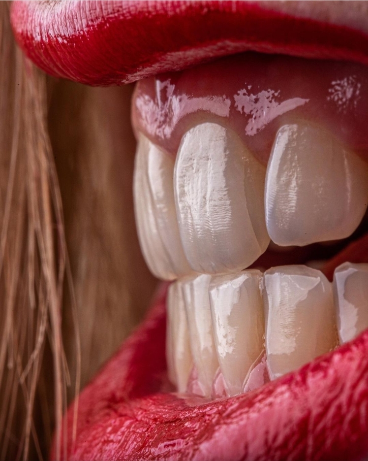 آیا میتوان لایههای کامپوزیت از برندهای مختلف را روی هم استفاده کرد؟